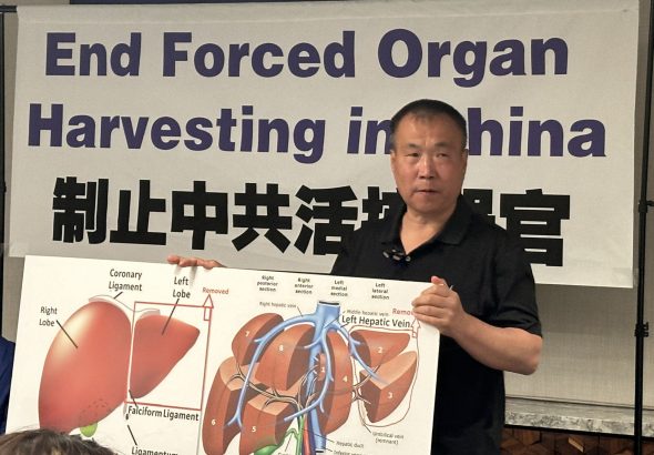 Cheng Peiming, practicante de Falun Gong al que se le extirparon a la fuerza parte del hígado y del pulmón en China, muestra su cicatriz tras una rueda de prensa en Washington el 9 de agosto de 2024. (Madalina Vasiliu/The Epoch Times)